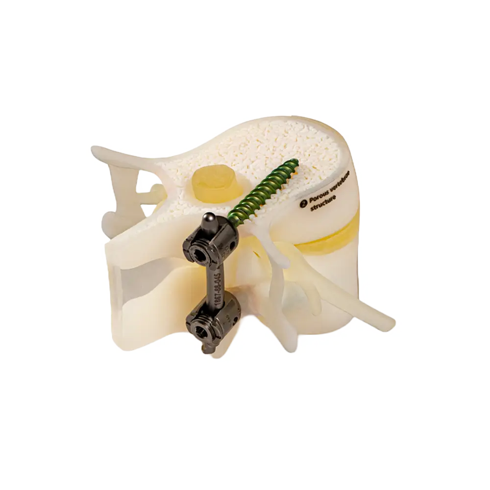 BoneMatrix rigid material for 3D printed bone structures