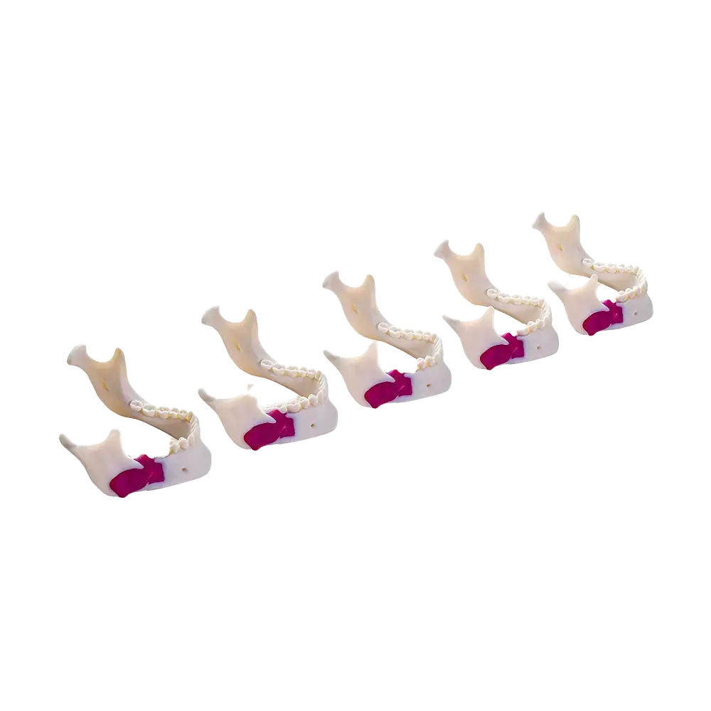 3D printed jaw models using DraftWhite MED857 material